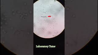 pus cell in urineLaboratory TutorMalayalam [upl. by O'Conner202]