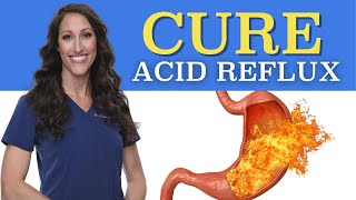 How to CURE GERD Permanently  Natural Treatment for Acid Reflux [upl. by Ityak]