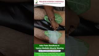 Arkapatra bandhana in vastus medialis muscle wasting ayurvedaayurvedtreatment ayurvedicmedicine [upl. by Jun]