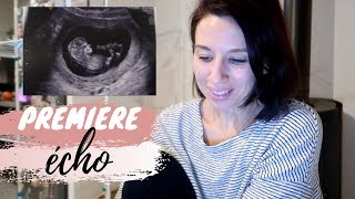 ECHOGRAPHIE DU PREMIER TRIMESTRE  ELYROSE VLOG [upl. by Jakoba]