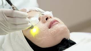 PERAWATAN DUAL YELLOW LASER DI NATASHA SKIN CLINIC CENTER [upl. by Eznyl]