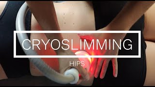 Cryoskin Révolution Tutorial cryoslimming hips session [upl. by Bordie994]