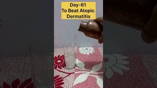 Day61 To Beat Atopic Dermatitis✅️ [upl. by Aivataj]