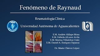 Fenómeno de Raynaud y Perniosis [upl. by Nnylatsirk]