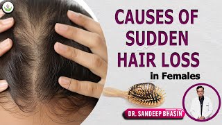 Causes of Sudden Hair Loss in Females Dr Sandeep Bhasin Reveals All  Care Well Medical Centre [upl. by Aruat]