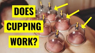 Does Cupping Therapy ACTUALLY Work [upl. by Onirefes]