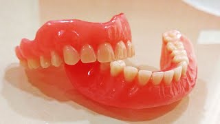 DENTURE FINISHING AND Denture POLISHING Denture deflasking in hindi [upl. by Nassir694]