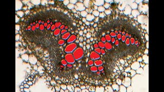 Pteridophytes Stelar system Plectostele and Mixed Protostele III [upl. by Limay180]