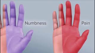 phalens test for carpal tunnel syndrome شرح بالعربي [upl. by Adekan905]