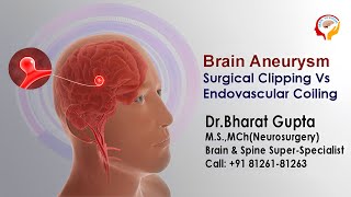 Brain Aneurysm Surgical Clipping Vs Endovascular Coiling I Dr Bharat Gupta [upl. by Ytsrik823]