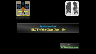 HRCT chest for Radiology Residents  Part 3b  Reticular Pattern [upl. by Shererd718]