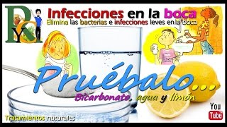 Remedio para las infecciones en la boca elimina las bacterias con limón y bicarbonato de sodio [upl. by Enelloc]