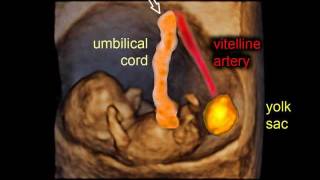 9 weeks of pregnancy gestational sac and embryo  3D scan [upl. by Lokkin]