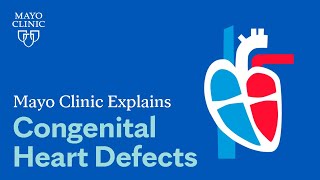 Mayo Clinic Explains Congenital Heart Defects [upl. by Roye130]