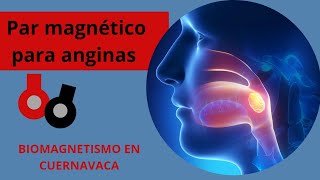 Como tratar la amigdalitis con biomagnetismo 🧲 [upl. by Koerlin147]