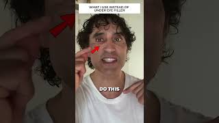 DISSOLVING MY UNDER EYE FILLER REACTION [upl. by Mendie]