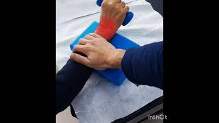 wrist fracture exercises wrist fracture exercise wristpain [upl. by Godwin]