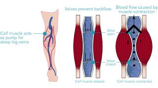 Soleus Muscle  Trigger Point Anatomy  Referred Pain [upl. by Alyac]