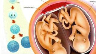 Everything You Need To Know About Fraternal and Identical Twins  Dr Sarah Finch [upl. by Weston237]