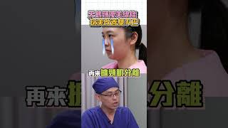 塑造天鵝頸 玩美改善雙下巴❗️台中教主 Dr吳孟穎醫師 天鵝頸手術 天鵝頸 雙下巴改善 雙下巴 台中醫美 台中天鵝頸 台中教主 吳孟穎醫師 [upl. by Annayk170]