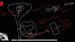 Emergency Acute Flaccid Paralysis [upl. by Ambrosane]