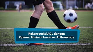 Rekonstruksi ACL dengan Operasi Minimal Invasive Arthroscopy [upl. by Ryan977]