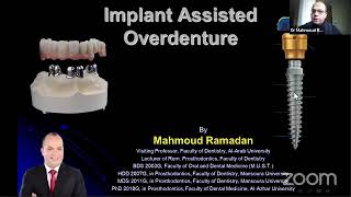 Implant Assisted Overdenture [upl. by Dunseath519]