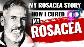 My Rosacea Story  How I Cured My Rosacea [upl. by Htebi677]