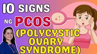 10 Signs ng PCOS Polycystic Ovary Syndrome  By Doc Liza RamosoOng [upl. by Dorris81]