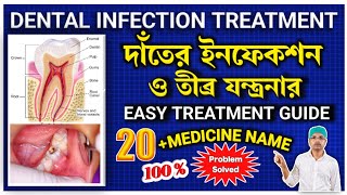 Dental infection treatment in banglaTooth infection treatmentTooth infection medicinedental [upl. by Grindle]