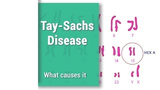 TaySachs Disease  THD  Hex A  Hexosaminidase A [upl. by Lonnard559]