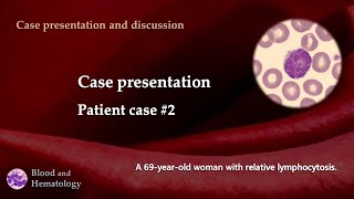 Patient case presentation case 2 [upl. by Madeleine]