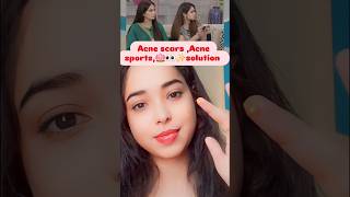 Acne scars acnescars acne acneremoval acnetreatment shorts beautytips skincare pimple short [upl. by Landsman98]