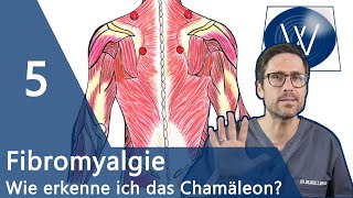 Fibromyalgie 5 sichere Anzeichen dass Sie am Fibromyalgie Syndrom FMS erkrankt sind [upl. by Assej]