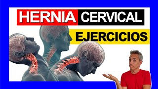 Hernia Discal CERVICAL C5 C6 Tratamiento  7 EJERCICIOS [upl. by Notyarb940]