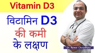 Symptoms of Vitamin D3 Deficiency  विटामिन D3 की कमी के लक्षण  How to increase Vitamin D3 in Body [upl. by Rus516]