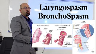 lec LaryngoSpasm amp Bronchospasm [upl. by Nolek]