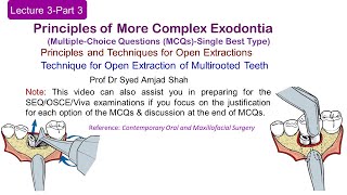 Lecture 3 Part3 MCQs  Technique for Open Extraction of Multirooted Teeth Multiple Choice Question [upl. by Trebron897]