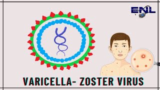 Varicella Zoster Virus  Microbiology  Explanation in Hindi [upl. by Deehahs]