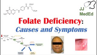 Folate Deficiency Causes ex medications Pathogenesis Symptoms Diagnosis and Treatment [upl. by Deb]