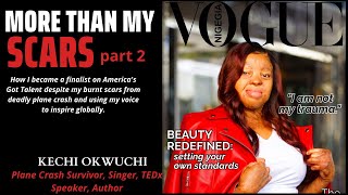 MORE THAN MY SCARS👉Part 2 Kechi Okwuchis storyroad to fame despite tragedy of deadly plane crash [upl. by Anehc]