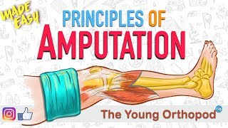 Amputation Principles  ANIMATION  BASICS  NEET PG  Amputee  The Young Orthopod [upl. by Aenitsirhc]