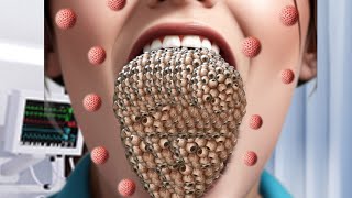 ASMR animation trypophobia Big size sleep treatments tongue  animation ASMR treatments filmiASMR [upl. by Yelsel]