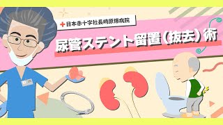 【日本赤十字社長崎原爆病院】尿管ステント留置術を受けられる患者様へ [upl. by Eneleuqcaj]