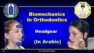 Use of Headgear in Orthodontics In Arabic [upl. by Blanchard]