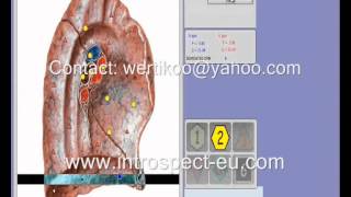 BioResonance NLS Diagnostic Main Functions OBERON  INTROSPECT  BIOSPECT [upl. by Bolme]