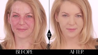 How to cover up birthmarks Charlotte Tilbury Magic Foundation Makeup Tutorials [upl. by Aderb]