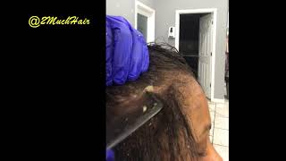 Part 4 Dermal Cleanse Scalp Scratching Flakes Removed 1 [upl. by Sherborne974]