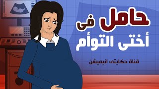 قصة التوأم الغريبة مستوحاة من احداث حقيقية  حكايتي انيميشن [upl. by Ehud]