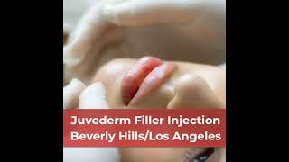 Juvederm Filler Injection Beverly Hills Los Angeles [upl. by Narrad]